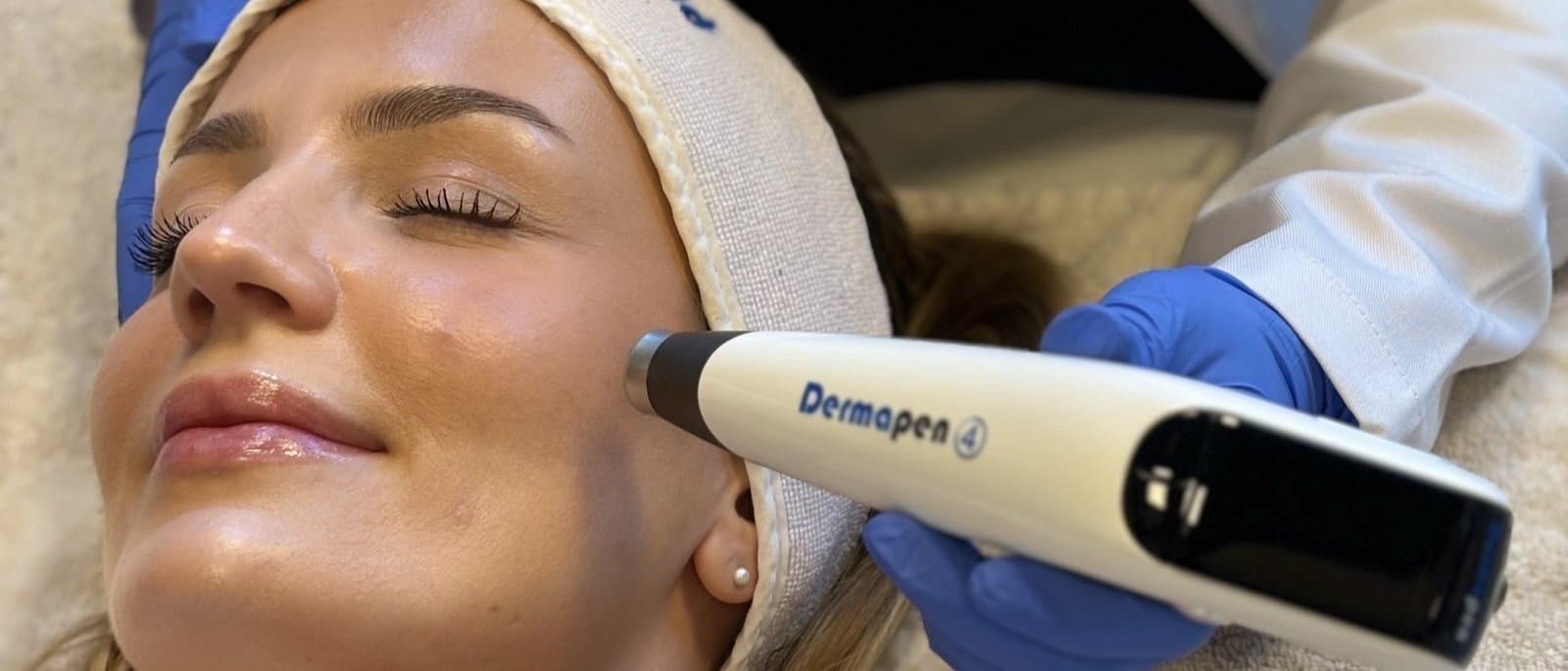 Microneedling-behandling med Dermapen hos Hud By Helseblikk